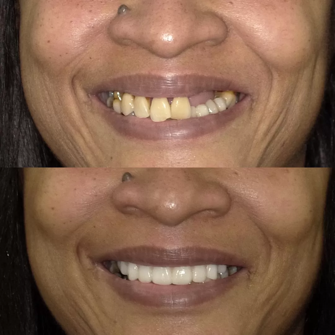 smile-gallery gallery